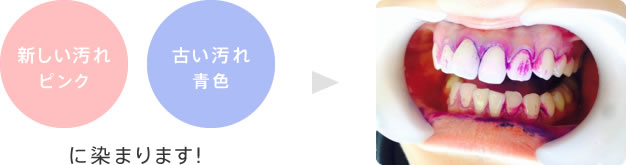 新しい汚れはピンク 古い汚れは青色に染まります