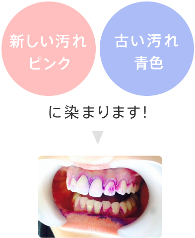 新しい汚れはピンク 古い汚れは青色に染まります