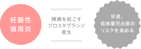 妊娠性歯周炎 陣痛を起こすプロスタグランジ産生 早産、低体重児出産のリスクを高める