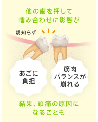 他の歯を押して噛み合わせに影響が。結果、頭痛の原因になることも。